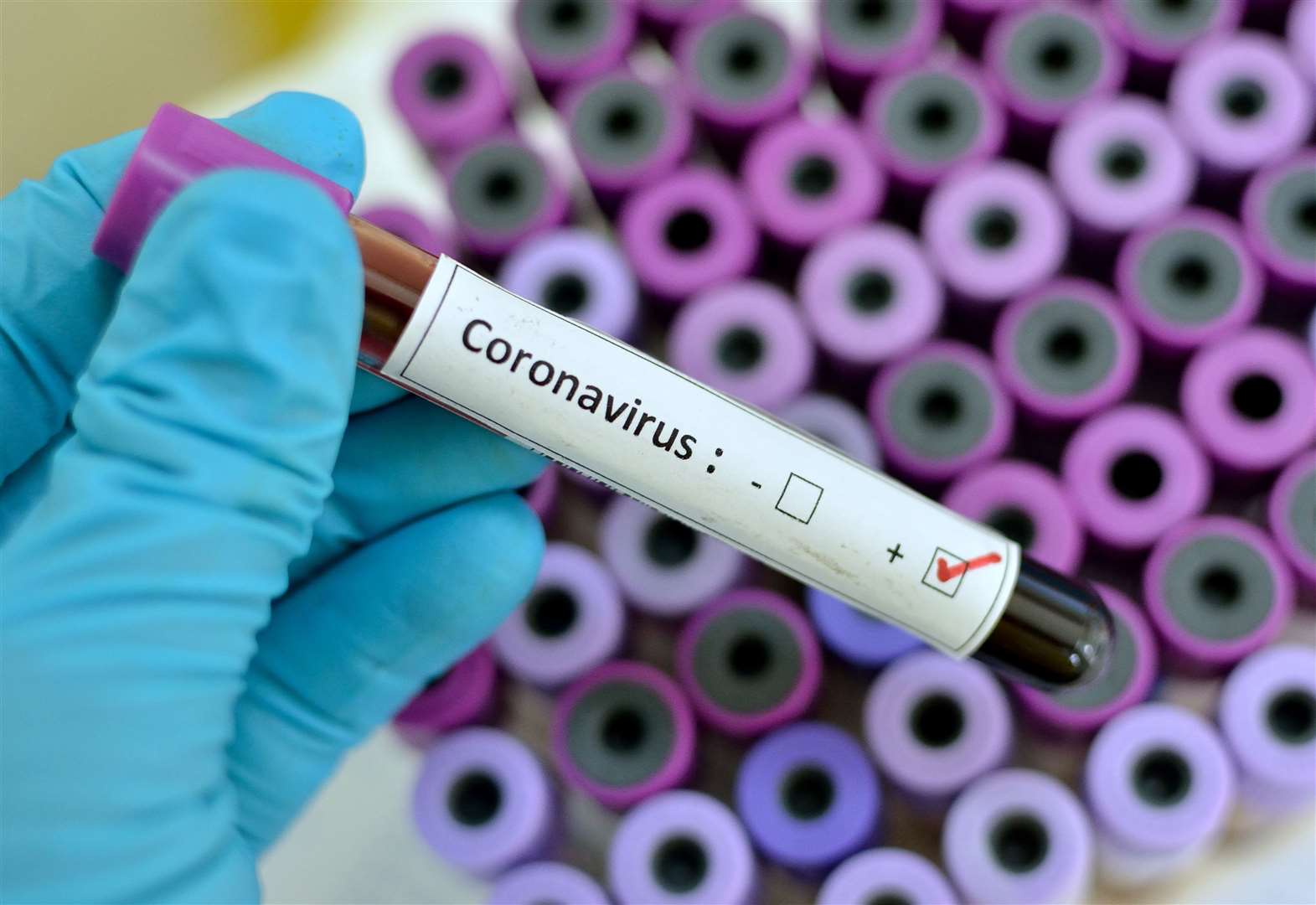 Boletim Coronavírus: Balneário Piçarras confirma 15 casos positivos da COVID-19