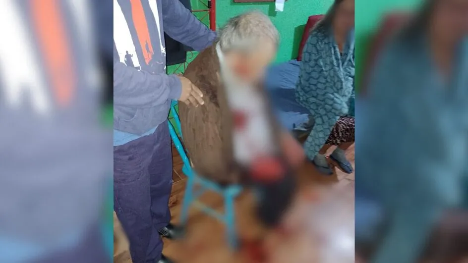Casal com mais de 80 anos é espancado durante assalto em Joinville