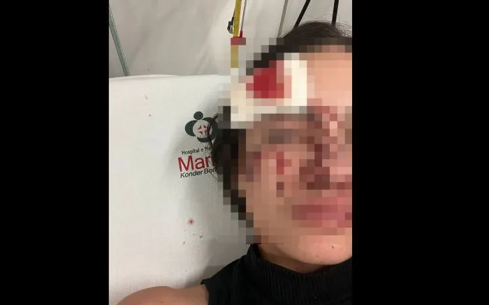 Polícia Civil investiga ataque à aluna na saída da Univali