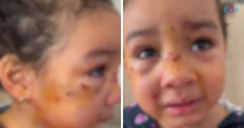Dono de Pit Bull que atacou menina de 3 anos em Navegantes é preso