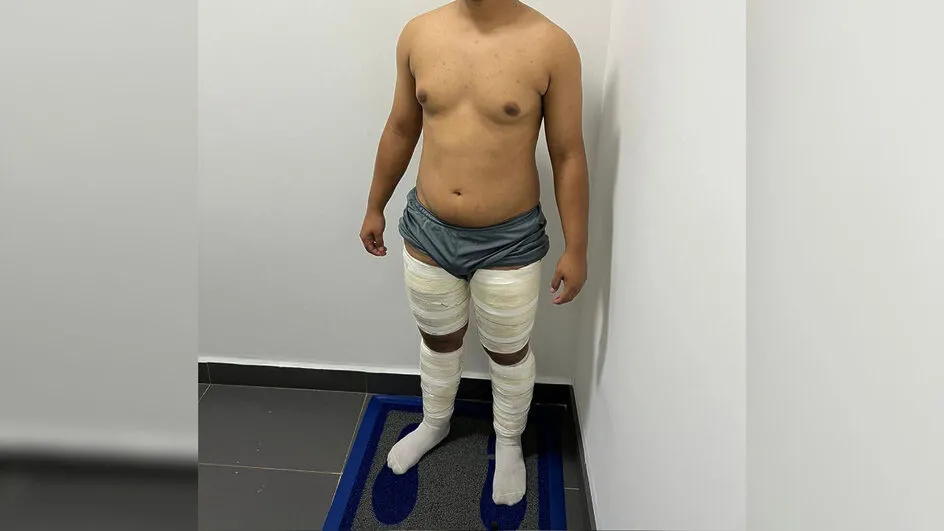 Jovem é preso no aeroporto de Navegantes a caminho de Paris levando cocaína presa ao corpo