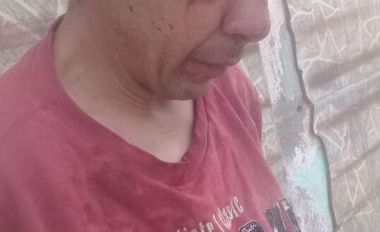 Levou porrada: Tentou levar menina de 11 anos para um matagal e apanhou da mãe da criança