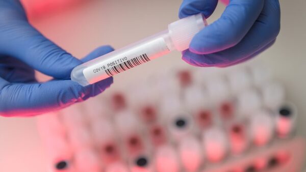 Suspeita de reinfecção por coronavírus no Hospital Marieta em Itajaí está sendo analisado pela DIVE