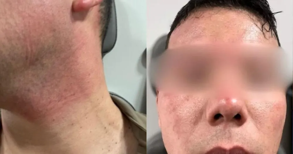 PMs de Balneário Piçarras são atacados por enxame de abelhas durante cerco policial, mas bandidos são presos
