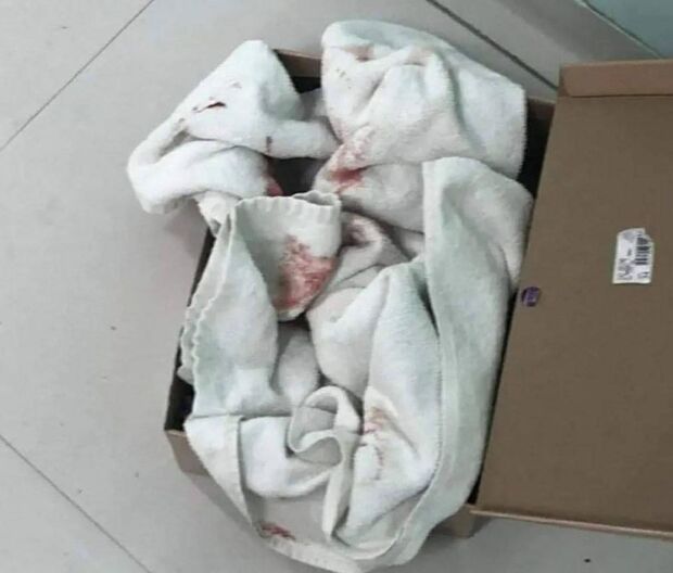 Bebê de 28 semanas é encontrada em uma caixa de sapato dentro de uma lixeira em Balneário Camboriú