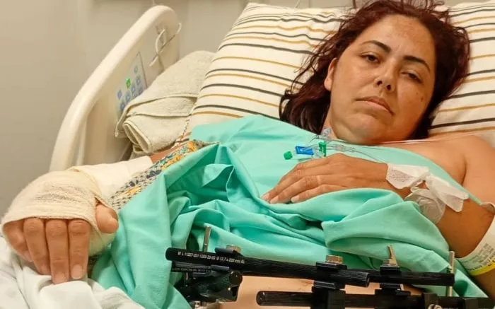 Moradora de Penha precisa de ajuda após acidente grave