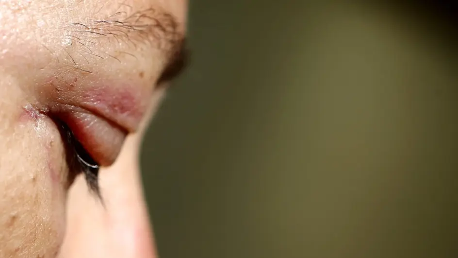 Dentista preso em Itapema prendia companheira em casa e a obrigou a tatuar o nome dele em várias partes do corpo