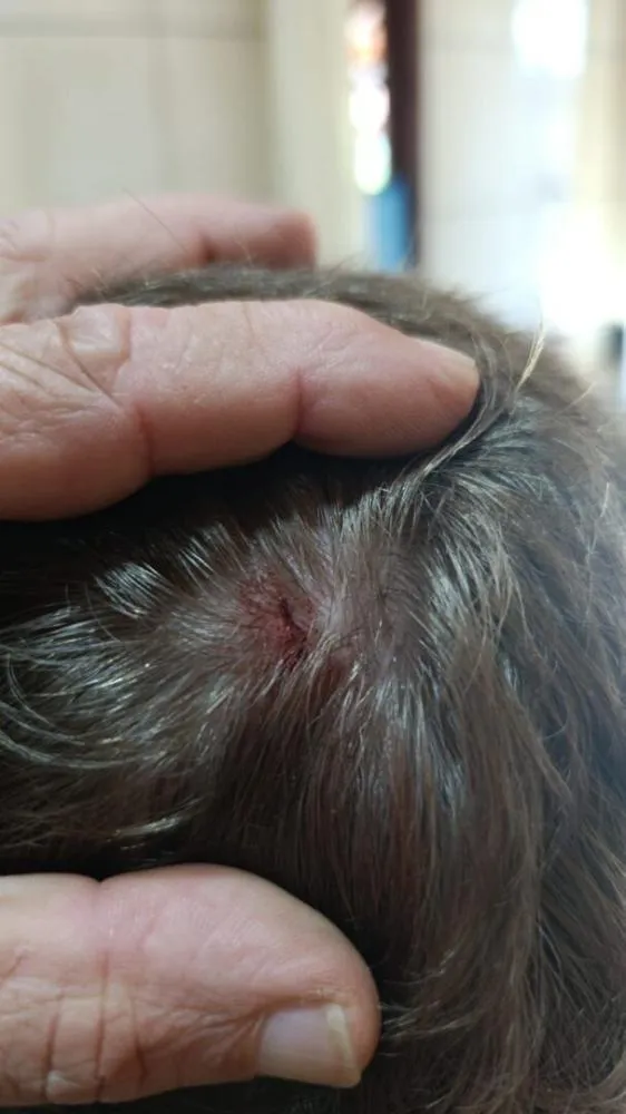 Assaltantes invadem casas, roubam armas e fazem criança de escudo em Ituporanga