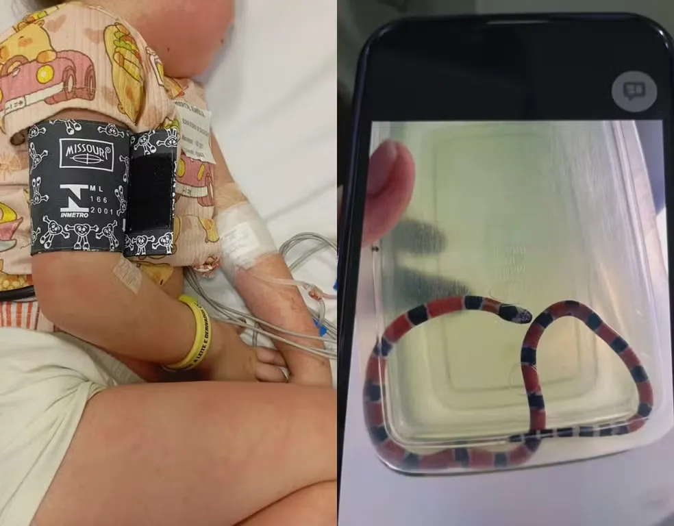 Menina de 4 anos sofre choque anafilático após irmão confundir cobra-coral com minhoca em Itajaí