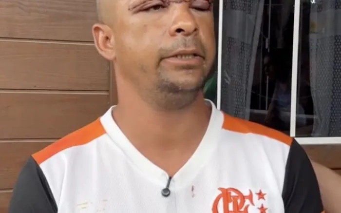 Motociclista de Navegantes leva 100 pontos no rosto por causa de linha com cerol