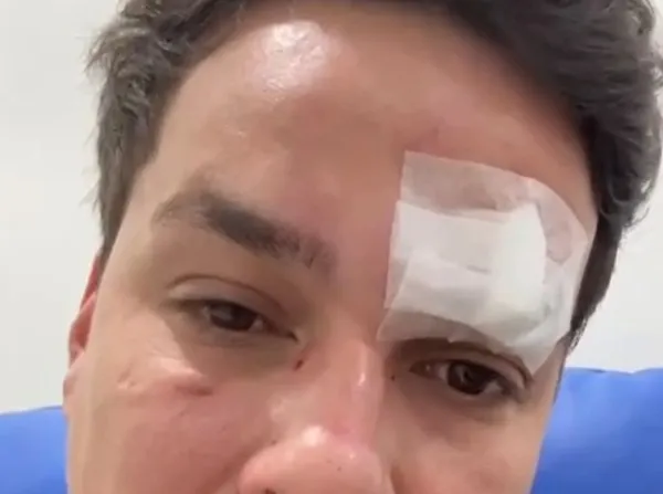 Vereador Júlio Bento é espancado com pedaço de pau no Porto das Balsas em Navegantes 