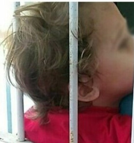 Itajaí: Menino de três anos sofre parada cardíaca ao ficar pendurado em grade de proteção de janela