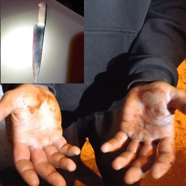 Navegantes - Homem é preso depois de golpear com pedradas e esfaquear desconhecido que lhe negou um cigarro