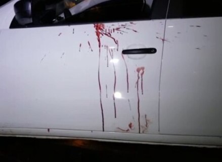 Barra Velha – Jovem de 26 anos sobrevive após ser baleado na testa e na costela no bairro Itajuba