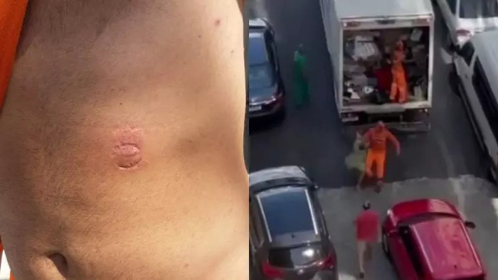 Boca Nervosa - Gari é atacado e leva mordida de mulher enquanto trabalhava em Itapema