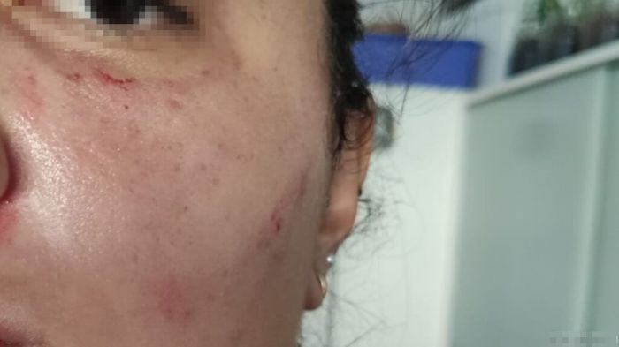 Balneário Camboriú - Mulher é agredida a chutes por atual companheira do ex-marido