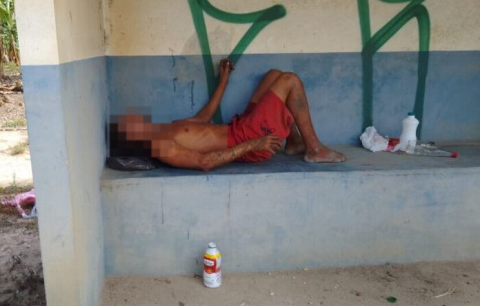 Maus-tratos – Morador de rua diz que foi “sequestrado” pela prefeitura de Balneário Camboriú e deixado em São João do Itaperiú