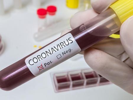Coronavírus: Penha confirma mais um caso positivo de COVID-19 na cidade