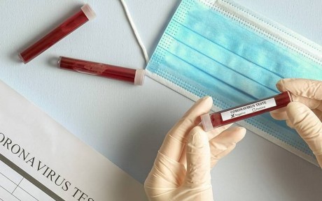 Boletim Coronavírus: São João do Itaperiú confirma o primeiro caso da COVID-19